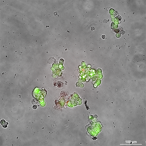 gen0_スフェロイド